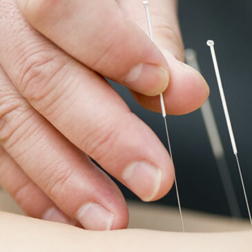 10 Uses Of Acupuncture
